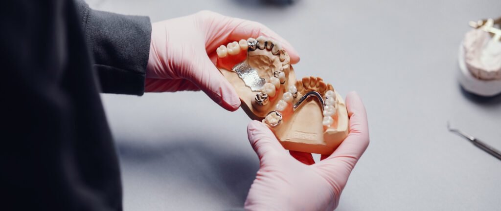 Implant-Supported Prostheses