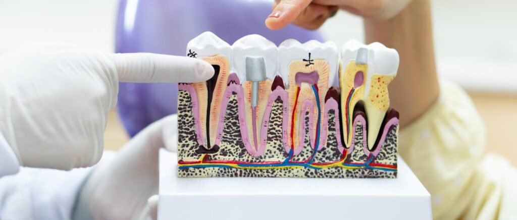 Microscopic view of root canal cleaning with rotary instruments.