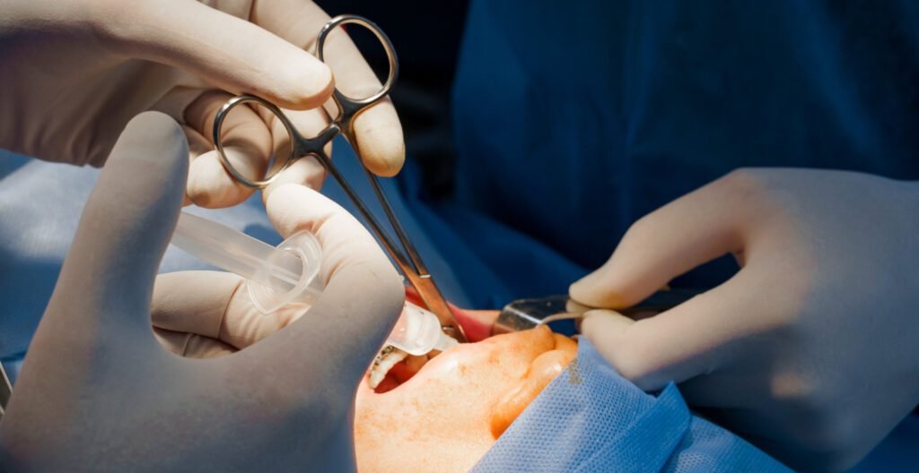 Doctors performing the teeth Surgery