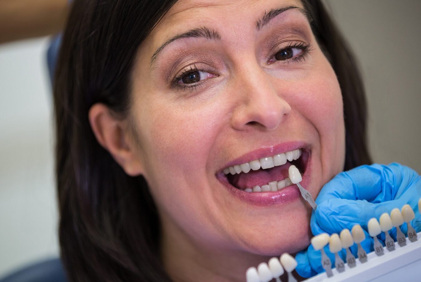 Dental Implants services